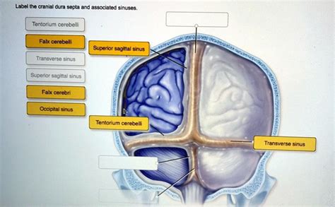 SOLVED: Label the cranial dura septa and associated sinuses. Tentorium ...