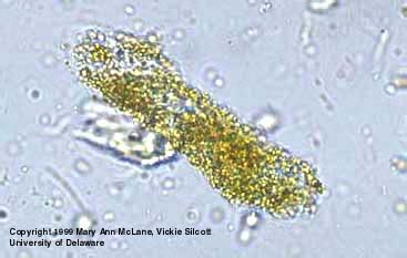 Granular Cast | Medical Laboratories