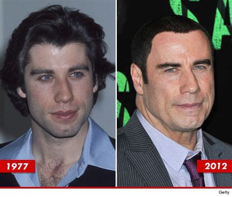 John Travolta: Good Genes or Good Docs? | Bad celebrity plastic surgery, Plastic surgery gone ...