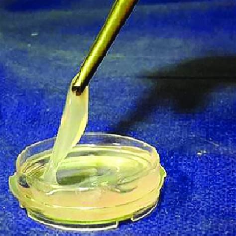 A gel-like fibrin glue formation after mixing of fibrinogen and thrombin. | Download Scientific ...