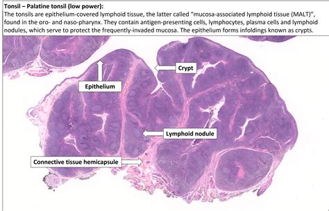 Tonsil – Normal Histology – NUS Pathweb :: NUS Pathweb