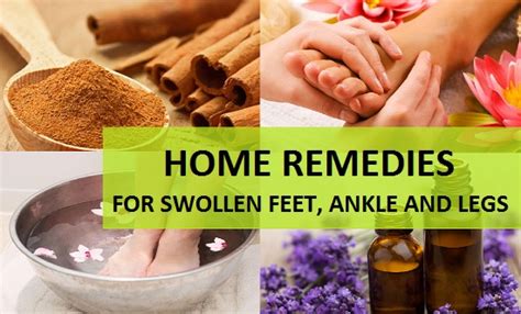 Home Remedies for Swollen Feet, Ankle and Legs