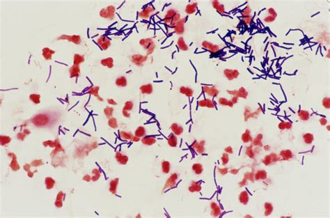 Lm Of Vaginal Smear: Lactobacillus Acidophilus Photograph by John Durham/science Photo Library ...