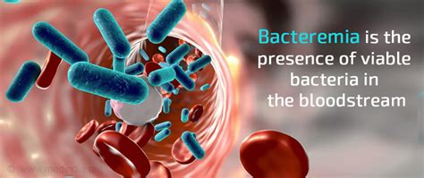 Bacteremia - Causes, Symptoms, Diagnosis, Treatment, Prevention