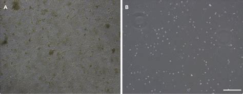 Debris removal by media changing Representative images of cell culture... | Download Scientific ...