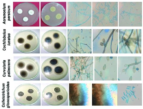 Morphological characteristics of endophytic fungi isolated from ...