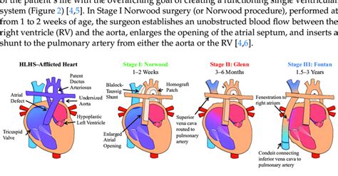 Overview of the characteristics of hypoplastic left heart syndrome... | Download Scientific Diagram