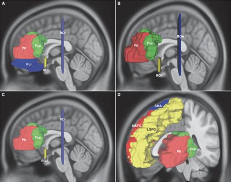 Frontiers | Association fiber tracts related to Broca’s area: A ...