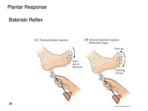 PPT - Reflex Exam PowerPoint Presentation, free download - ID:4083243