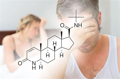 Finasteride side effects: what are they? - Insalaco Clinic