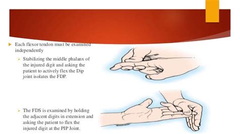 Fds And Fdp Tendons Test / Secondary Procedures for Failed Tendon Transfers ... - The ...