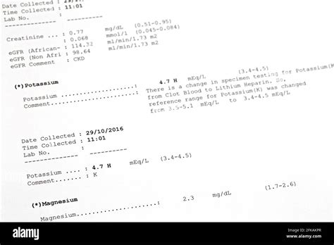 Soft focus of printed result paper of Potassium, Magnesium Levels in ...