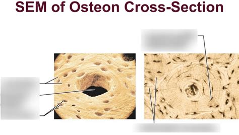 A&P 1, Ament, Chapter 6: Bone Histology: SEM of Osteon Cross-Section ...