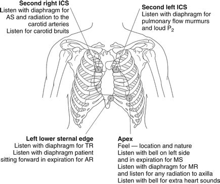 Aortic Valve Murmur Sound