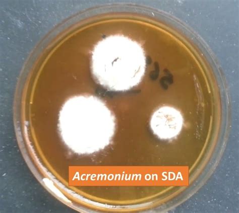 Acremonium species: Introduction, Morphology, Pathogenecity, Lab