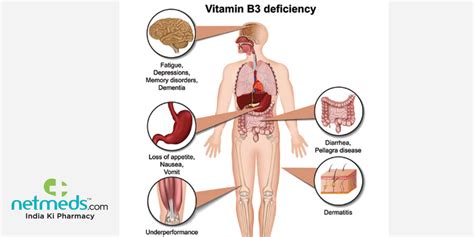 Pellagra: Causes, Symptoms And Treatment Of This Vitamin B3 Deficiency ...