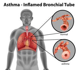 Beta-2 Agonists | Mechanism, Side Effects, Clinical Pharmacology!