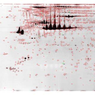 Comparison of two-dimensional (2D) gel electrophoresis results using... | Download Scientific ...