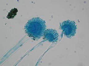 Aspergillus flavus - Alchetron, The Free Social Encyclopedia