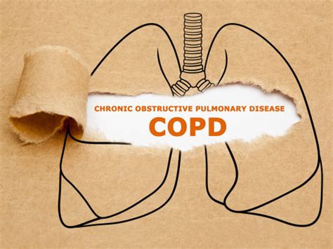 Comprehensive Training on COPD: Symptoms, Treatment, and Management ...