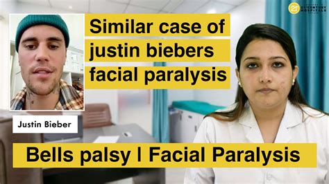 Similar Case of Justin Biebers Facial Paralysis | Bells Palsy | Facial Paralysis | Bell's palsy ...