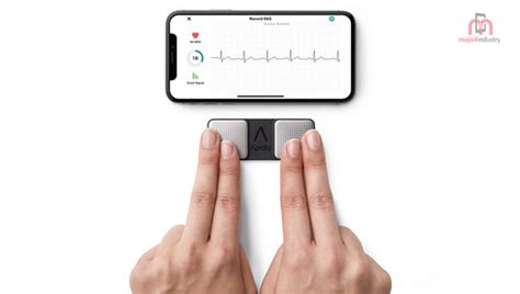 AliveCors’ KardiaMobile alerts irregular heart rhythm symptoms 24 hours in advance | industry ...