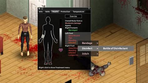 Project Zomboid – How to Stop Bleeding - Gamer Empire