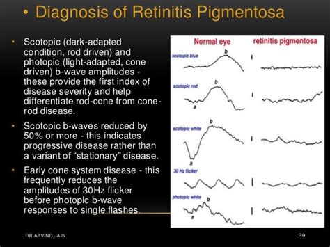 ELECTRORETINOGRAM BASICS PDF