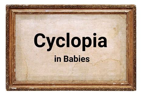 Cyclopia in Babies - What is it , Symptoms and Risk Factors - Being The Parent