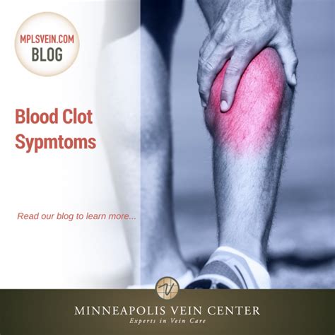 What Are The Signs Of A Blood Clot In Your Calf Muscle at Simone Davis blog