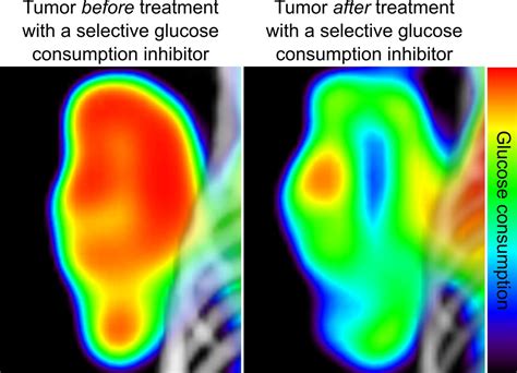 Automated technique helps identify cancer cell metabolism inhibitors | UCLA