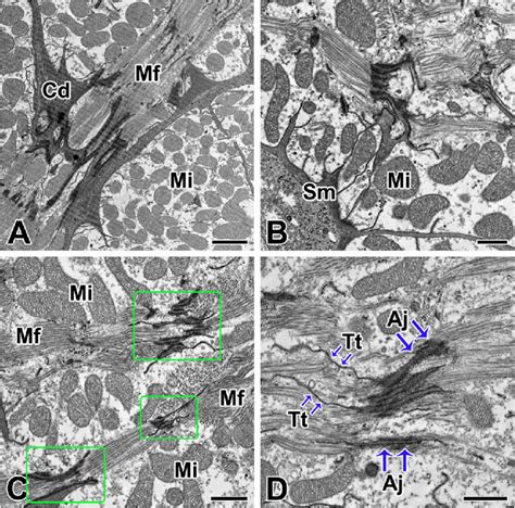 Transmission electron micrographs of the intercalated disc in the... | Download Scientific Diagram