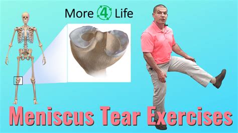 Meniscus Tear Exercises To Avoid and What To Do Instead