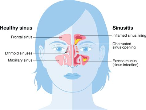 Breathing & Sinus | Biltmore ENT | ENT Phoenix, AZ - Biltmore Ent