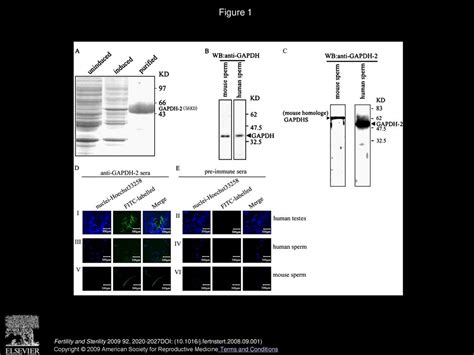 Experimental immunological infertility effect of anti-GAPDH-2 ...