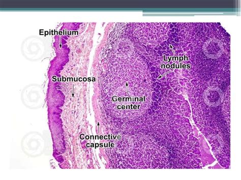 Histology of Tonsil