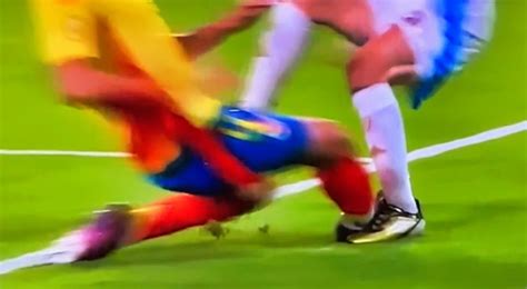 VIDEO: New Camera Angle Shows Lionel Messi’s Nasty Ankle Injury From Copa America Final That ...