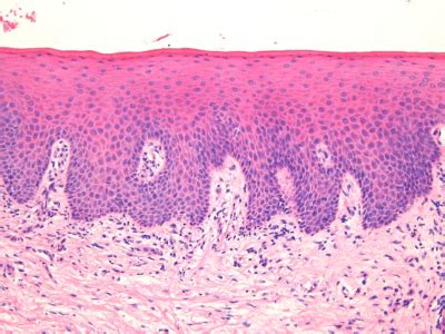 Lip Mucosa Histology | Sitelip.org