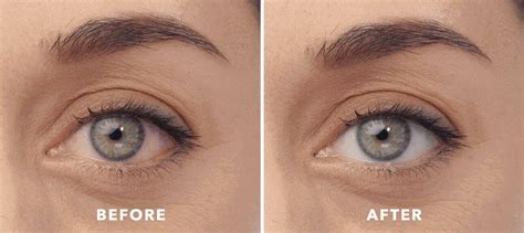 The Science Behind LUMIFY® Redness Reliever Eye Drops