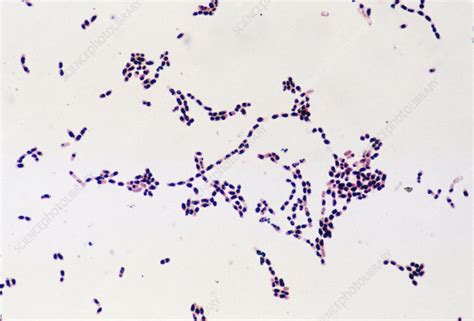 Bacillus Cereus Gram Stain