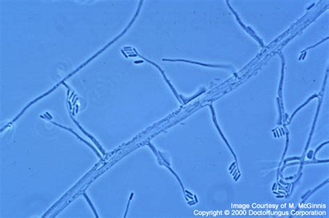 Acremonium Species - Doctor Fungus