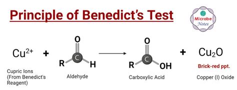 Benedict’s Test- Principle, Procedure, Steps, Results, Uses