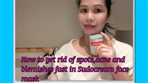 How to get rid of spots,acne and blemishes fast Sudocrem face mask ...