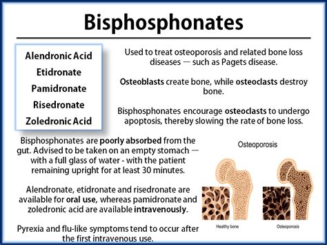 Bisphosphonates | Pharmacology, Pharmacology nursing, Nursing exam