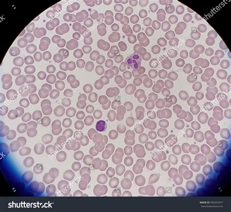 Human Blood Smear Normal Red Blood Stock Photo 596353457 | Shutterstock