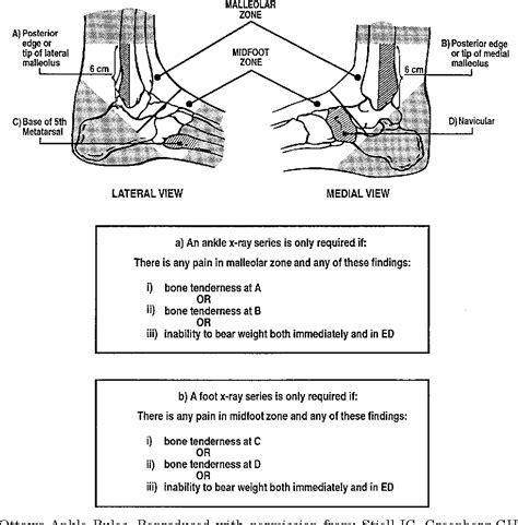 Figure 1 from Validation of the Ottawa Ankle Rules in children with ...