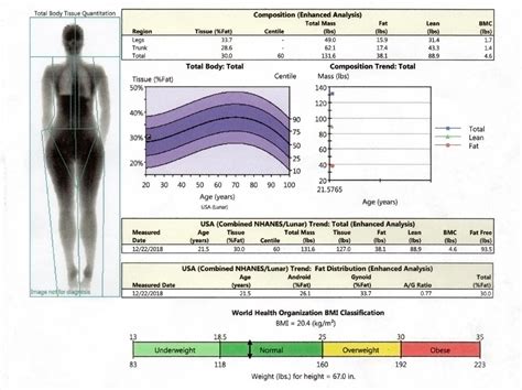 Dexa Scan | Bone Mineral Density Tool | ARC Recovery & Rehabilitation