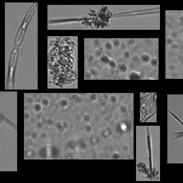 (PDF) Deep Learning for Microalgae Classification