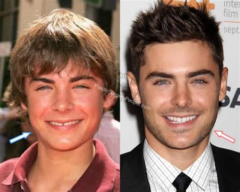 Zac Efron, Before and After 2020