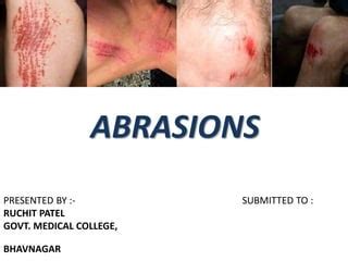 Skin Abrasion